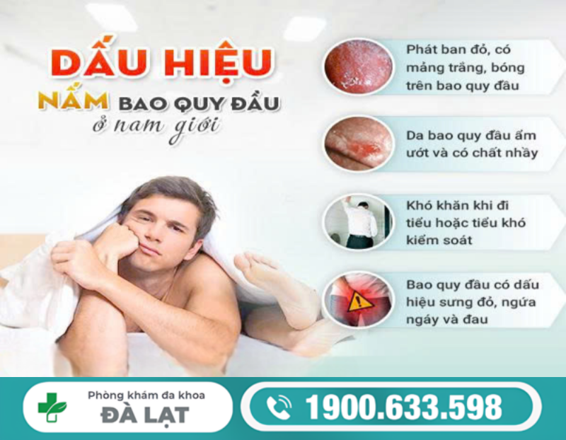 Hình ảnh minh họa